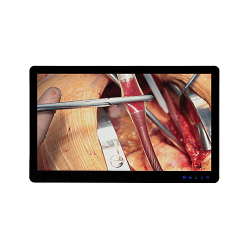 55" Medical Cert 4K-Monitor DICOM Preset without Touch
